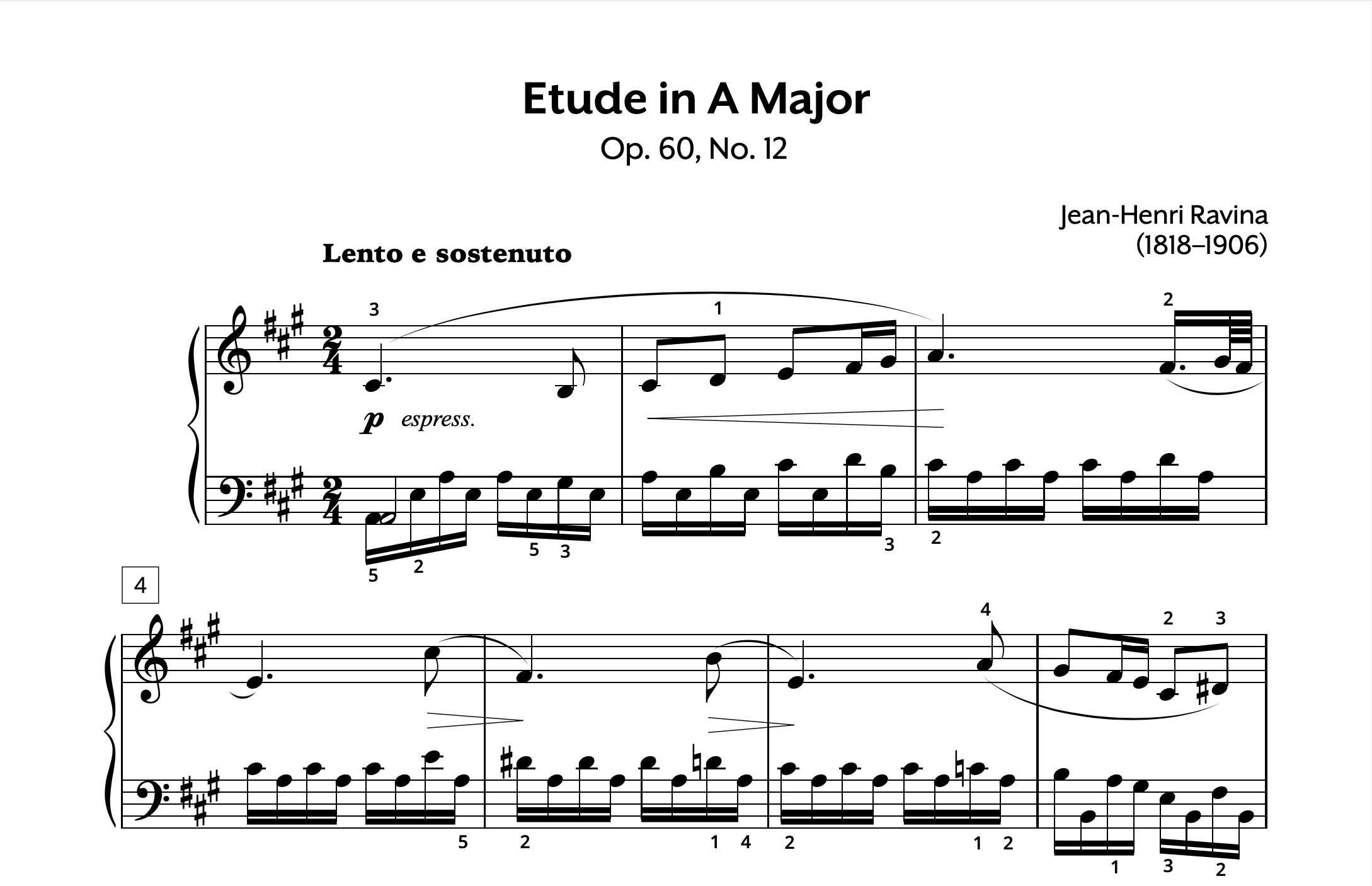 Ravina Etude in A Op. 60 No. 12 Store Preview