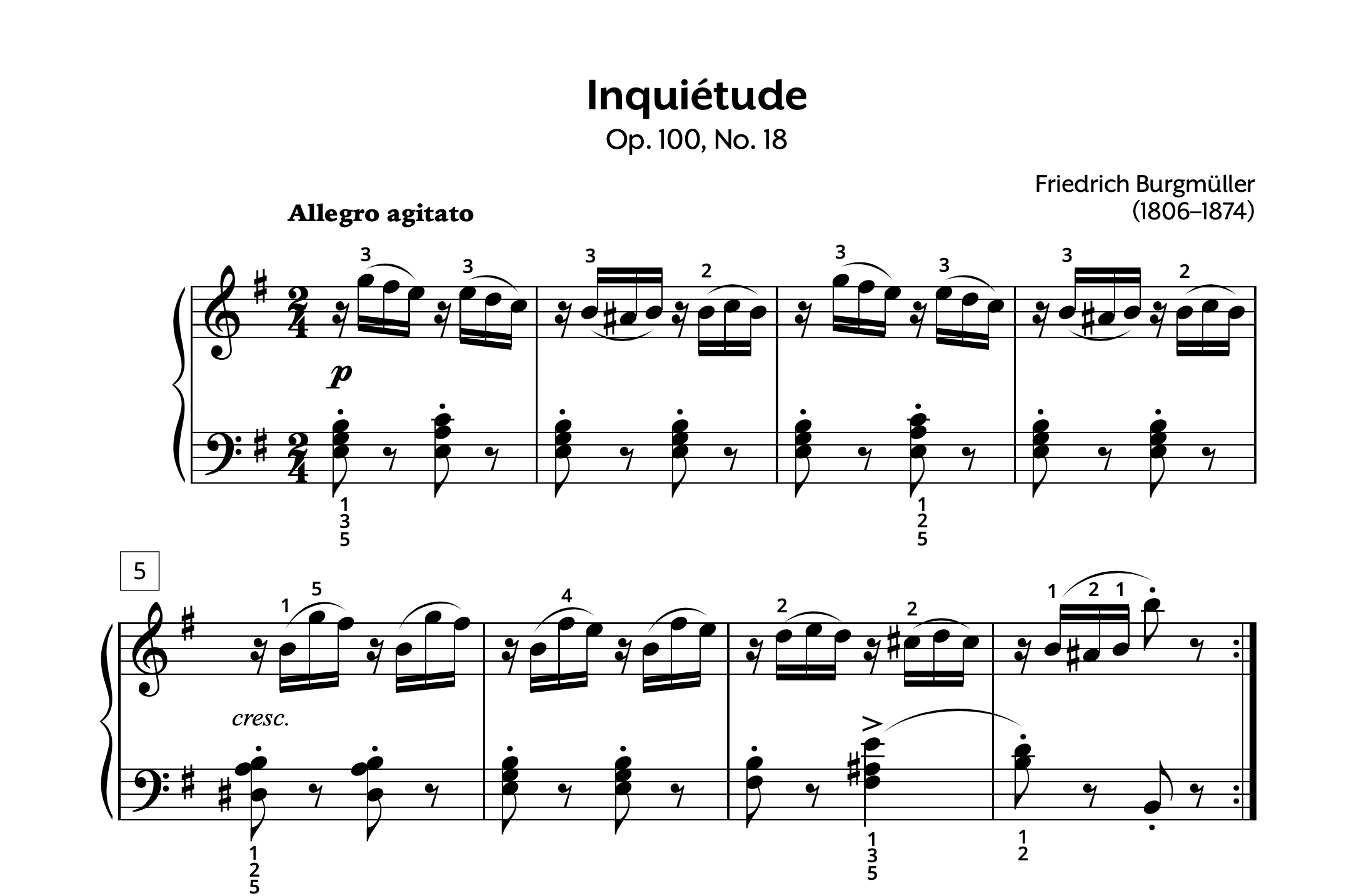 Burgmuller Op. 100 #18 Inquietude Store Preview
